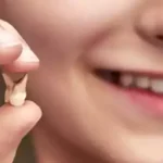 5 Arti Mimpi Gigi Copot Lengkap Bagian Atas, Bawah, Kanan, Kiri